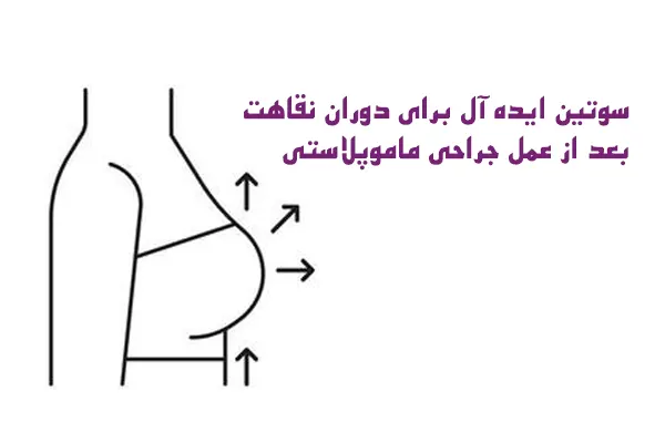 نظرات در مورد عمل پروتز سينه+سوتین طبی بعد از پروتزسینه+سوتین لیفت کننده چسبی+ماندگاری فیلر باسن+نظرات در مورد فیلر باسن