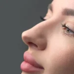 تفاوت بینی گوشتی و استخوانی در رینوپلاستی