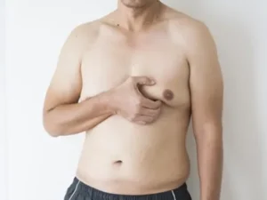 نحوه تشخیص ژنیکوماستی