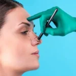 چه بیماری هایی مانع عمل بینی میشود؟