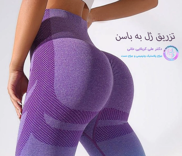  تزریق ژل به باسن