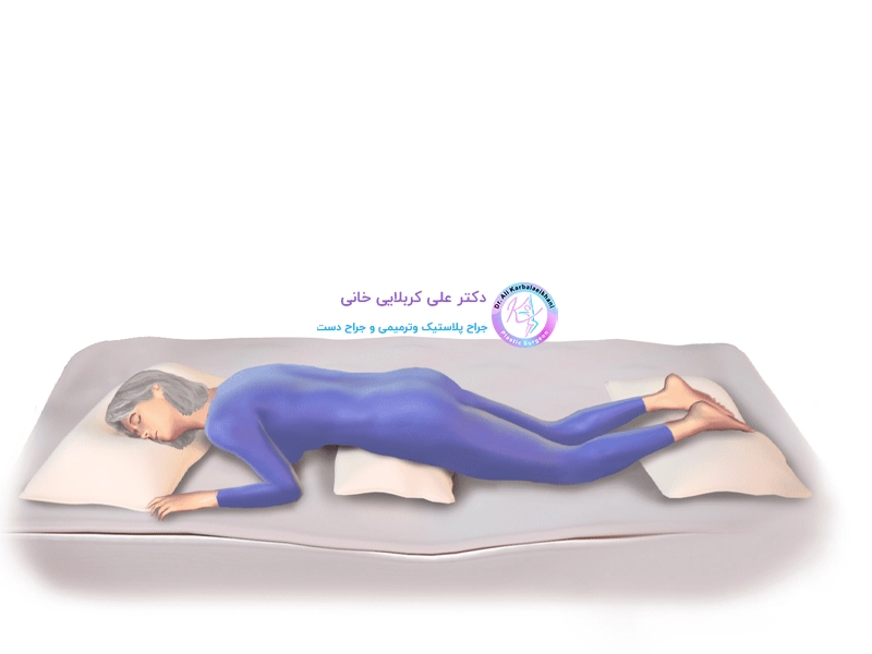 بهترین حالت خوابیدن بعد تزریق چربی به باسن