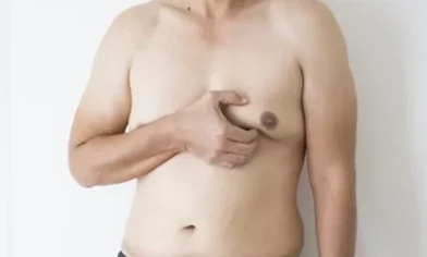 نحوه تشخیص ژنیکوماستی